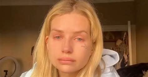 lottie moss face tattoo|Lottie Moss shows off results of face tattoo removal after admitting ...